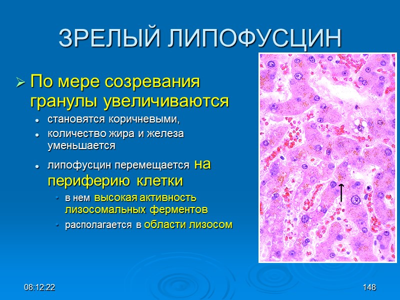 08:12:02 148 ЗРЕЛЫЙ ЛИПОФУСЦИН По мере созревания гранулы увеличиваются становятся коричневыми,  количество жира